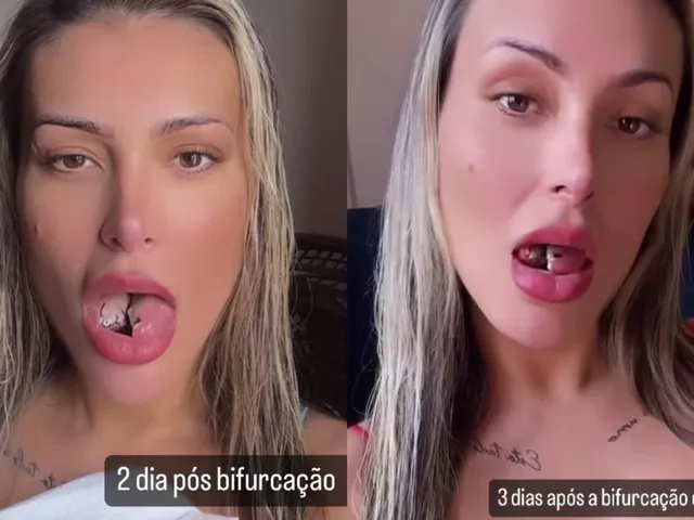 https://timnews.com.br/system/images/photos/16309954/original/urach?1722610155